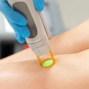 Révélez votre Beauté Naturelle avec l’Épilation Laser en Suisse